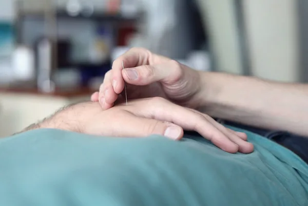 Mãos do terapeuta aplicando uma agulha fina no dorso da mão do paciente