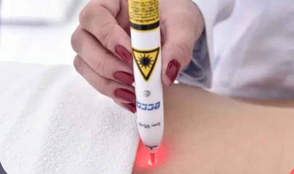 Caneta de laserterapia com luz vermelha aplicada sobre a pele